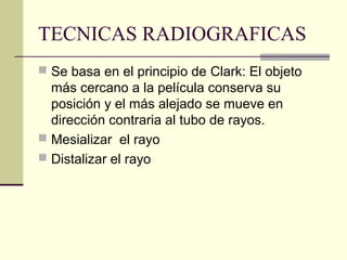 TECNICAS RADIOGRAFICAS
 Se basa en el principio de Clark: El objeto
más cercano a la película conserva su
posición y el más alejado se mueve en
dirección contraria al tubo de rayos.
 Mesializar el rayo
 Distalizar el rayo
 
