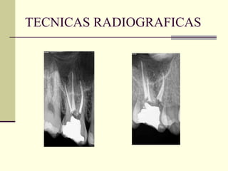 TECNICAS RADIOGRAFICAS
 