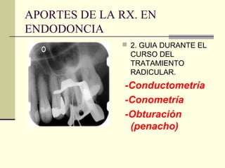 APORTES DE LA RX. EN
ENDODONCIA
 2. GUIA DURANTE EL
CURSO DEL
TRATAMIENTO
RADICULAR.
-Conductometría
-Conometría
-Obturación
(penacho)
 
