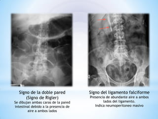 radiografia-simple-de-abdomen ........pdf