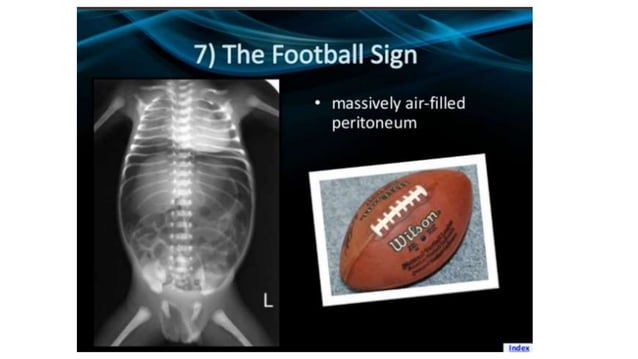 RADIOGRAFI_ABDOMEN_radiologi_abdomen_.pptx