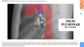 radiografia-b-sica-para-interpretar-el-corazon-pptx