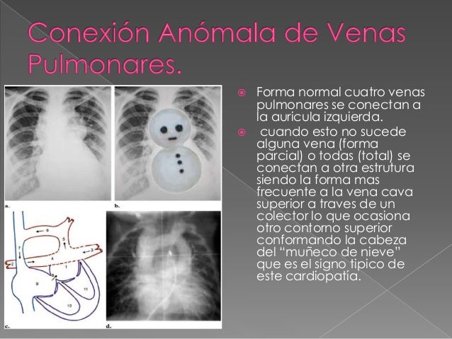 Radiografia cardiologia2