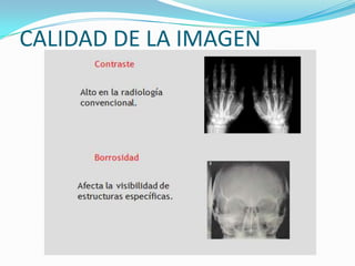 CALIDAD DE LA IMAGEN
 