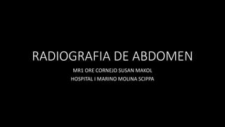 RADIOGRAFIA DE ABDOMEN
MR1 ORE CORNEJO SUSAN MAKOL
HOSPITAL I MARINO MOLINA SCIPPA
 