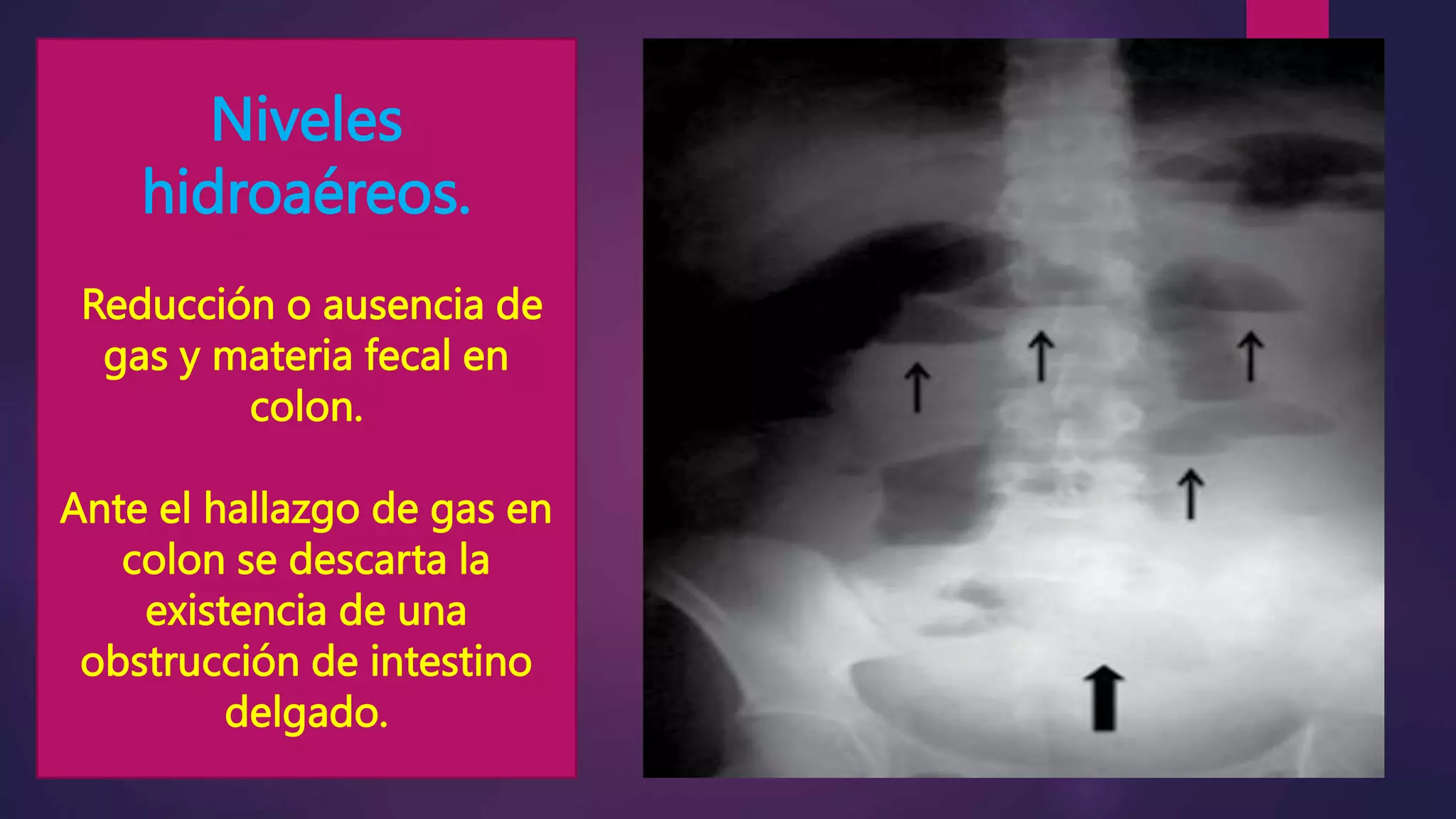 Radiografia De Abdomen pptx radiografia-de-abdomen-pptx