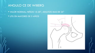 Radiografias de la cadera y la pelvis.pptx