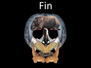 LIOM, indicada con la línea roja, debe  quedar paralela al borde superior de la superficie.