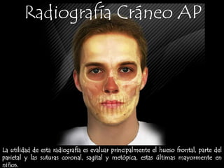 Radiografía Cráneo APLa utilidad de esta radiografía es evaluar principalmente el hueso frontal, parte del parietal y las suturas coronal, sagital y metópica, estas últimas mayormente en niños.