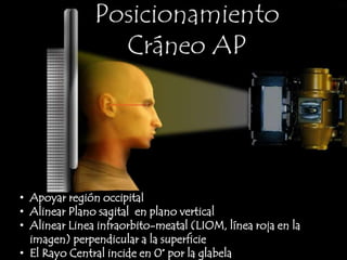 Apoyar región occipital