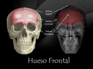 Alinear Plano sagital  en plano vertical