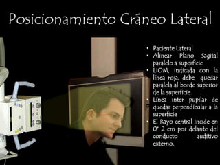 El Rayo Central incide en 0° por la glabelaSutura SagitalSutura CoronalSutura Metópica