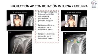 Presentación de Radiografia de Hombro y Codo.pptx