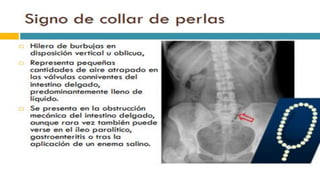 RADIOGRAFIA DEL INTESTINO DELGADO.pdf