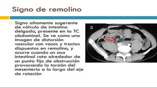 RADIOGRAFIA DEL INTESTINO DELGADO.pdf