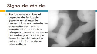 RADIOGRAFIA DEL INTESTINO DELGADO.pdf