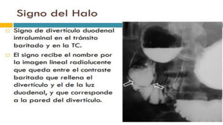 RADIOGRAFIA DEL INTESTINO DELGADO.pdf