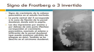 RADIOGRAFIA DEL INTESTINO DELGADO.pdf