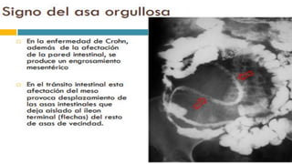 RADIOGRAFIA DEL INTESTINO DELGADO.pdf