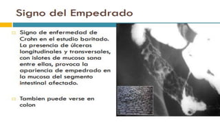 RADIOGRAFIA DEL INTESTINO DELGADO.pdf