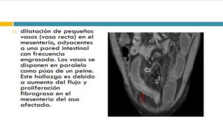 RADIOGRAFIA DEL INTESTINO DELGADO.pdf