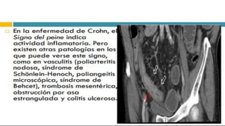 RADIOGRAFIA DEL INTESTINO DELGADO.pdf