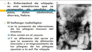 RADIOGRAFIA DEL INTESTINO DELGADO.pdf