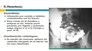 RADIOGRAFIA DEL INTESTINO DELGADO.pdf