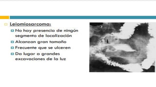 RADIOGRAFIA DEL INTESTINO DELGADO.pdf