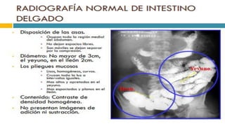 RADIOGRAFIA DEL INTESTINO DELGADO.pdf