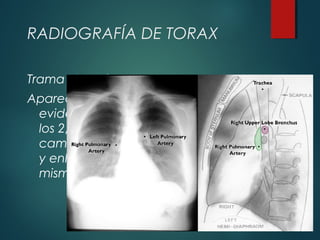 RADIOGRAFÍA DE TORAX
Trama Vascular:
Aparece más
evidentemente en
los 2/3 internos del
campo pulmonar
y enla base del
mismo
 