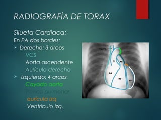 RADIOGRAFÍA DE TORAX
Silueta Cardiaca:
En PA dos bordes:
 Derecho: 3 arcos
VCS
Aorta ascendente
Aurícula derecha
 Izquierdo: 4 arcos
Cayado aorta
Tronco pulmonar
aurícula izq
Ventrículo Izq.
 