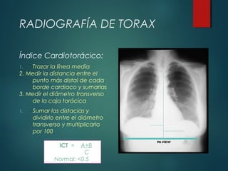 RADIOGRAFÍA DE TORAX
Índice Cardiotorácico:
1. Trazar la línea media
2. Medir la distancia entre el
punto más distal de cada
borde cardiaco y sumarlas
3. Medir el diámetro transverso
de la caja torácica
1. Sumar las distacias y
dividirlo entre el diámetro
transverso y multiplicarlo
por 100
ICT = A+B
C
Normal: <0.5
 