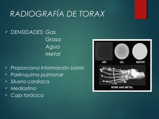 RADIOGRAFÍA DE TORAX
 DENSIDADES: Gas
Grasa
Agua
Metal
 Proporciona información sobre:
 Parénquima pulmonar
 Silueta cardiaca
 Mediastino
 Caja torácica
 