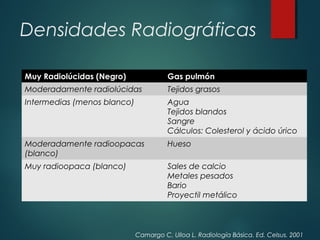 Densidades Radiográficas
Muy Radiolúcidas (Negro) Gas pulmón
Moderadamente radiolúcidas Tejidos grasos
Intermedias (menos blanco) Agua
Tejidos blandos
Sangre
Cálculos: Colesterol y ácido úrico
Moderadamente radioopacas
(blanco)
Hueso
Muy radioopaca (blanco) Sales de calcio
Metales pesados
Bario
Proyectil metálico
Camargo C, Ulloa L. Radiología Básica. Ed. Celsus. 2001
 
