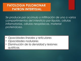PATOLOGIA PULOMONAR
PATRON INTERTISIAL
• Opacidades lineales y reticulares
• Opacidades nodulares
• Disminución de la densidad y lesiones
quísticas.
Se produce por acúmulo o infiltración de uno o varios
compartimientos del intersticio por líquido, células
inflamatorias, células neoplásicas, material
proteináceo.
 