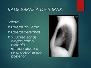 RADIOGRAFÍA DE TORAX
Lateral:
 Lateral izquierda
 Lateral derechas
 Visualiza zonas
ciegas como
espacio
retrocardiaco o
seno costofrénico
posterior.
 