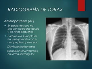 RADIOGRAFÍA DE TORAX
Anteroposterior (AP)
 En pacientes que no
pueden colocarse de pie
y en niños pequeños
 Parámetros: Omóplatos
en superposición con el
campo pleuropulmonar
Clavículas horizontales
Espacios intervertebrales
en forma rectangular
 