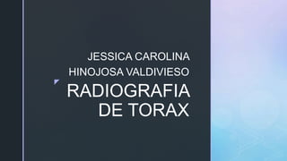 z
RADIOGRAFIA
DE TORAX
JESSICA CAROLINA
HINOJOSA VALDIVIESO
 