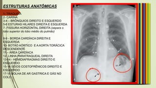 ESTRUTURAS ANATÔMICAS
1- TRAQUEIA
2- CARINA
3-4 – BRÔNQUIOS DIREITO E ESQUERDO
5-6 ESTURAS HILARES DIREITA E ESQUERDA
7- FISSURA HORIZONTAL DIREITA (separa o
lobo superior do lobo médio do pulmão)
8-9 - BORDA CARDÍACA DIREITA E
ESQUERDA
10- BOTÃO AÓRTICO E A AORTA TORÁCICA
DESCENDENTE
11 – ÁREA CARDÍACA
12- LINHA PARATRAQUEAL DIREITA
13-14 - HEMIDIAFRAGMAS DIREITO E
ESQUERDO
15-16 SEIOS COSTOFRÊNICOS DIREITO E
ESQUERDO
17-18 BOLHA DE AR GASTRICA E GÁS NO
COLO
 