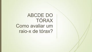 ABCDE DO
TÓRAX
Como avaliar um
raio-x de tórax?
 