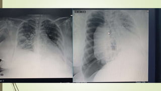 Title Lorem Ipsum Dolor Sit Amet
2017
Lorem ipsum dolor sit amet
2018
Lorem ipsum dolor sit amet
2019
Lorem ipsum dolor sit amet
 