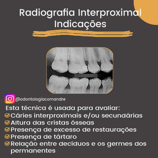 Radiografia Interproximal Indicações - Concurso Odontologia Resumo.pdf