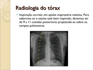 Radiologia do tórax Inspiração correta:  em apnéia inspiratória máxima. Para sabermos se o exame está bem inspirado, devemos ter de 9 a 11 costelas posteriores projetando-se sobre os campos pulmonares. 