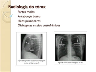 Radiologia do tórax Partes moles Arcabouço ósseo Hilos pulmonares Diafragmas e seios costofrênicos 