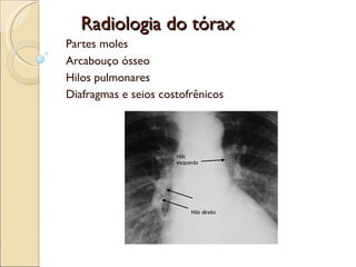 Radiologia do tórax Partes moles Arcabouço ósseo Hilos pulmonares Diafragmas e seios costofrênicos 