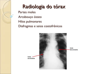 Radiologia do tórax Partes moles Arcabouço ósseo Hilos pulmonares Diafragmas e seios costofrênicos 