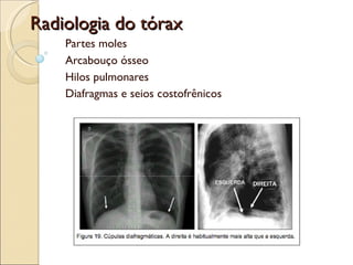 Radiologia do tórax Partes moles Arcabouço ósseo Hilos pulmonares Diafragmas e seios costofrênicos 
