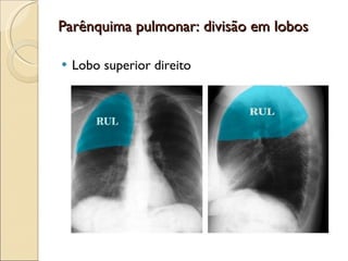 Parênquima pulmonar: divisão em lobos Lobo superior direito 