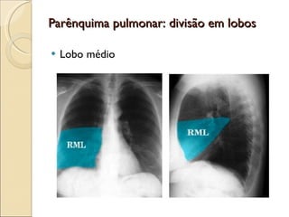 Parênquima pulmonar: divisão em lobos Lobo médio 